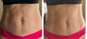 BARRIGA