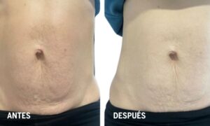 BARRIGA